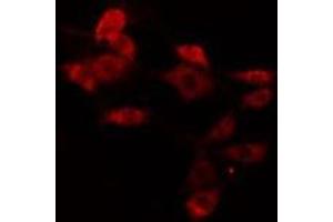 ABIN6275775 staining Hela cells by IF/ICC. (IFIT5 antibody  (Internal Region))