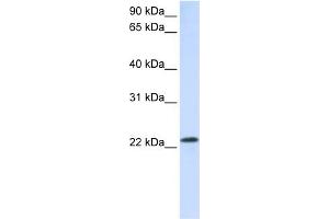 WB Suggested Anti-RAB18 Antibody Titration:  0. (RAB18 antibody  (C-Term))