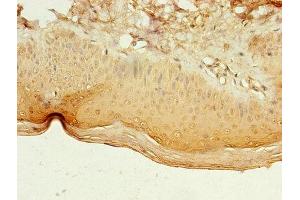 Immunohistochemistry of paraffin-embedded human skin tissue using ABIN7158260 at dilution of 1:100 (LILRA4 antibody  (AA 289-424))