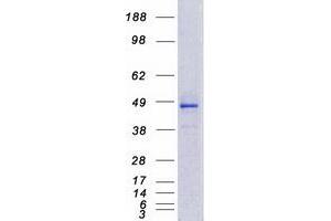 Validation with Western Blot (CYP4F12 Protein (Myc-DYKDDDDK Tag))