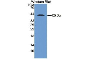 Detection of Recombinant DSC2, Human using Polyclonal Antibody to Desmocollin 2 (DSC2) (Desmocollin 2 antibody  (AA 136-471))