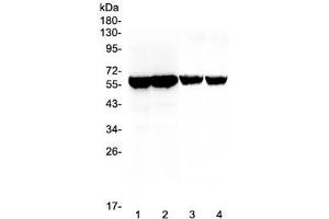Western blot testing of different lots of mouse testis lysate (lanes 1, 2) and rat testis lysate (lanes 3, 4) with Cyp17a1 antibody at 0.