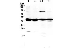 Western blot analysis of ADA using anti-ADA antibody . (ADA antibody  (AA 2-241))