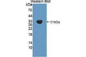 Western blot analysis of the recombinant protein. (GAB2 antibody  (AA 357-607))