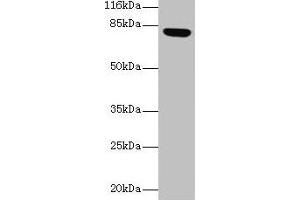 Western blot All lanes: Lhcgr antibody at 2 μg/mL + Rat gonadal tissue Secondary Goat polyclonal to rabbit IgG at 1/10000 dilution Predicted band size: 79, 35, 38, 73, 28, 33, 21, 72, 31, 34, 41 kDa Observed band size: 79 kDa (LHCGR antibody  (AA 27-362))