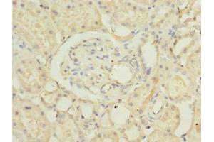 Immunohistochemistry of paraffin-embedded human kidney tissue using ABIN7168469 at dilution of 1:100 (RUSC1 antibody  (AA 231-433))