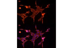 Immunofluorescence (IF) image for anti-Aldo-Keto Reductase Family 1, Member B1 (Aldose Reductase) (AKR1B1) (AA 1-316) antibody (ABIN3022391)