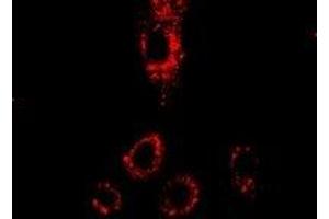 Immunofluorescent analysis of p43 staining in HepG2 cells. (p43 antibody)