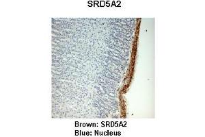 Sample Type :  Monkey adrenal gland   Primary Antibody Dilution :   1:25   Secondary Antibody:  Anti-rabbit-HRP   Secondary Antibody Dilution:   1:1000   Color/Signal Descriptions:  Brown: SRD5A2 Blue: Nucleus   Gene Name:  SRD5A2   Submitted by:  Jonathan Bertin, Endoceutics Inc. (SRD5A2 antibody  (N-Term))