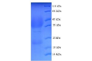 LHCGR Protein (AA 27-363) (His tag)