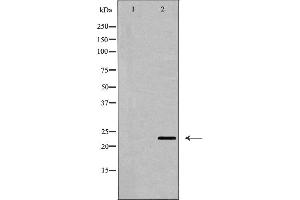 Western blot analysis of CD69 expression in Jurkat cell lysate,The lane on the left is treated with the antigen-specific peptide. (CD69 antibody  (Internal Region))