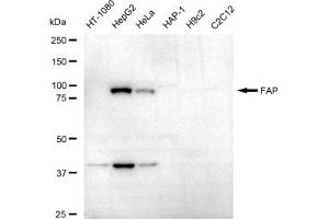 Western blotting analysis using FAP antibody (ABIN7798602).