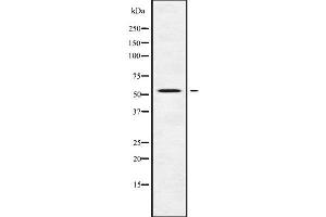 DFNA5 antibody  (C-Term)