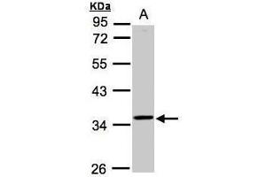WB Image Sample(30 ug whole cell lysate) A:Raji , 10% SDS PAGE antibody diluted at 1:1000 (RG9MTD3 antibody  (Center))