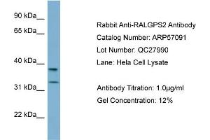 WB Suggested Anti-RALGPS2  Antibody Titration: 0.