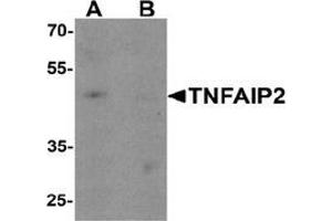 Western blot analysis of TNFAIP2 in K562 cell lysate with TNFAIP2 Antibody  at 1 ug/ml in (A) the absence and (B) the presence of blocking peptide.
