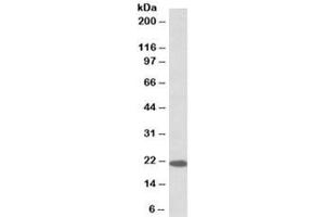 Western blot testing of human cerebellum lysate with Dnajc5 antibody at 0. (DNAJC5 antibody)
