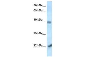 Western Blot showing Vps72 antibody used at a concentration of 1. (VPS72 antibody  (N-Term))