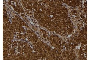 Immunohistochemistry (IHC) image for anti-Eukaryotic Translation Initiation Factor 2 Subunit 1 (EIF2S1) (N-Term) antibody (ABIN6261472)