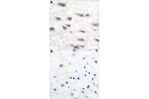 Immunohistochemical staining of human brain tissue by NTRK1 (phospho Y791) polyclonal antibody  without blocking peptide (A) or preincubated with blocking peptide (B) under 1:50-1:100 dilution. (TRKA antibody  (pTyr791))