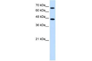 WB Suggested Anti-NR4A2 Antibody Titration:  0. (NR4A2 antibody  (C-Term))