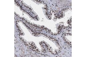 Immunohistochemical staining of human prostate with PHF12 polyclonal antibody  shows strong nuclear positivity in glandular cells.