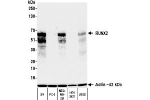 Western Blotting (WB) image for anti-Runt-Related Transcription Factor 2 (RUNX2) (AA 300-350) antibody (ABIN7795798)