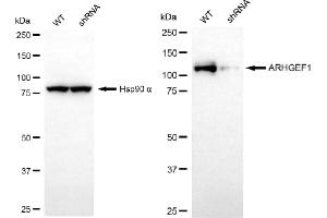 Western blotting analysis using ARHGEF1 antibody (ABIN7800200). (ARHGEF1 antibody)