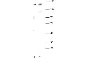AIB1 antibody (pAb) tested by Western blot. (NCOA3 antibody)