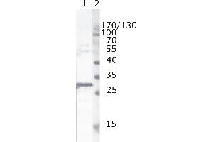 Western Blot testing of HIV-1 recombinant Nef protein. (HIV-1 Nef (AA 163-173) antibody)