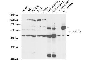 Western blot analysis of extracts of various cell lines, using CDK antibody (ABIN6131010, ABIN6138333, ABIN6138334 and ABIN6221451) at 1:1000 dilution. (CDKAL1 antibody  (AA 1-230))