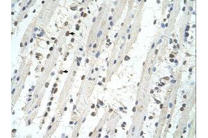 Immunohistochemistry (IHC) image for anti-Tripartite Motif Containing 32 (TRIM32) (C-Term) antibody (ABIN2780866) (TRIM32 antibody  (C-Term))