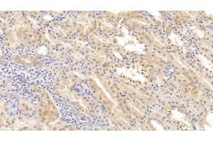 Detection of HIF2a in Human Kidney Tissue using Polyclonal Antibody to Hypoxia Inducible Factor 2 Alpha (HIF2a) (EPAS1 antibody  (AA 26-347))