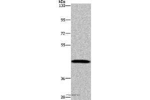 Western blot analysis of Human hepatocellular carcinoma tissue, using CYP1A2 Polyclonal Antibody at dilution of 1:440