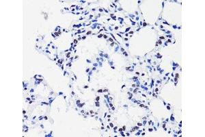 Immunohistochemistry of paraffin-embedded Rat lung using Acetyl-Histone H2B-K15 Polyclonal Antibody at dilution of 1:100 (40x lens). (Histone H2B antibody  (acLys15))