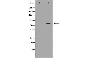 Western blot analysis of extracts of mouse eyetissue lysate, using SLC5A1antibody. (SLC5A1 antibody  (Internal Region))