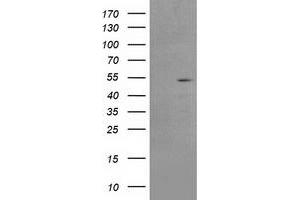 HEK293T cells were transfected with the pCMV6-ENTRY control (Left lane) or pCMV6-ENTRY AP2M1 (Right lane) cDNA for 48 hrs and lysed. (AP2M1 antibody  (AA 97-383))