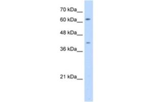 Western Blotting (WB) image for anti-SWAP Switching B-Cell Complex 70kDa Subunit (SWAP70) antibody (ABIN2462957) (SWAP70 antibody)