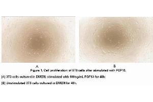 Image no. 2 for Fibroblast Growth Factor 13 (FGF13) (AA 1-192) (Active) protein (His tag) (ABIN6239865)