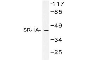 Image no. 1 for anti-Serotonin Receptor 1A (HTR1A) antibody (ABIN272268)