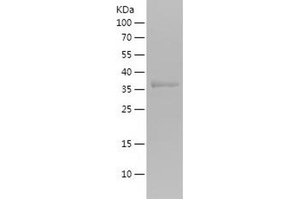 HBG1 Protein (AA 1-125) (His-IF2DI Tag)