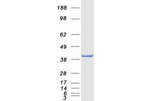 Western Blotting (WB) image for Aldolase A, Fructose-Bisphosphate (ALDOA) (Transcript Variant 1) protein (Myc-DYKDDDDK Tag) (ABIN2714554)