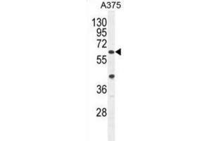 Western Blotting (WB) image for anti-APOBEC1 Complementation Factor (A1CF) antibody (ABIN2995767)