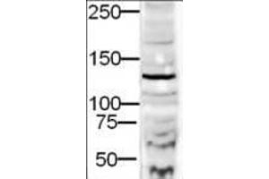 Western blot using  Affinity Purified anti-DIA-2 antibody shows detection of a 132-kDa band corresponding to DIA-2 in a lysate prepared from human derived HEK293 cells. (DIA2 antibody  (AA 1085-1101))