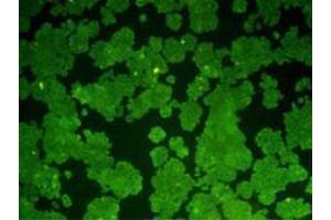 Immunocytochemistry (ICC) image for anti-B-Cell CLL/lymphoma 2 (BCL2) antibody (ABIN1112797) (Bcl-2 antibody)