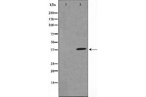 Western blot analysis of IkappaB-alpha expression in TNF-α treated MCF7 whole cell lysates,The lane on the left is treated with the antigen-specific peptide. (NFKBIA antibody  (N-Term))