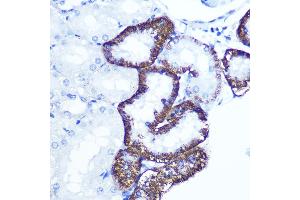 Immunohistochemistry of paraffin-embedded rat kidney using EXTL3 Rabbit pAb (ABIN1679782, ABIN3018195, ABIN3018196 and ABIN6220395) at dilution of 1:100 (40x lens). (EXTL3 antibody  (AA 52-220))