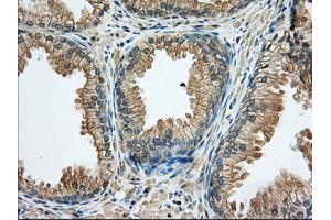 Immunohistochemical staining of paraffin-embedded Human liver tissue using anti-RAB17 mouse monoclonal antibody.