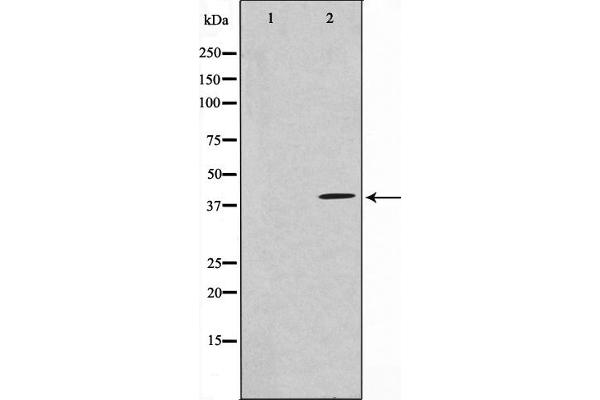 HEXIM1 antibody