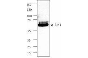 Western Blotting (WB) image for anti-Bridging Integrator 1 (BIN1) antibody (ABIN2664071) (BIN1 antibody)